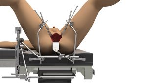 GYN System