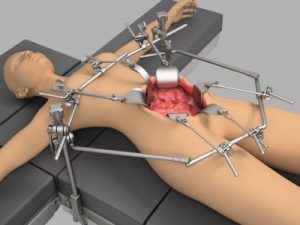GYN Oncology System