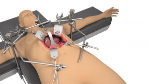 Liver / Oncology System
