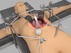 Radiolucent Liver / Oncology System