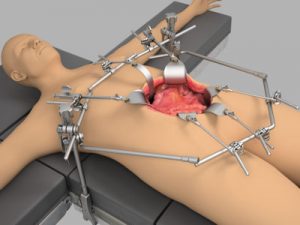 Urologic Oncology System