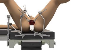 Urology System