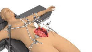 General, Vascular System