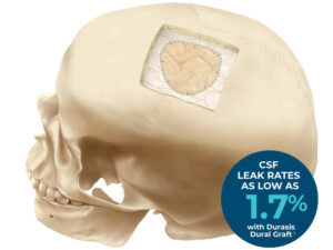 Durasis™ Dural Graft